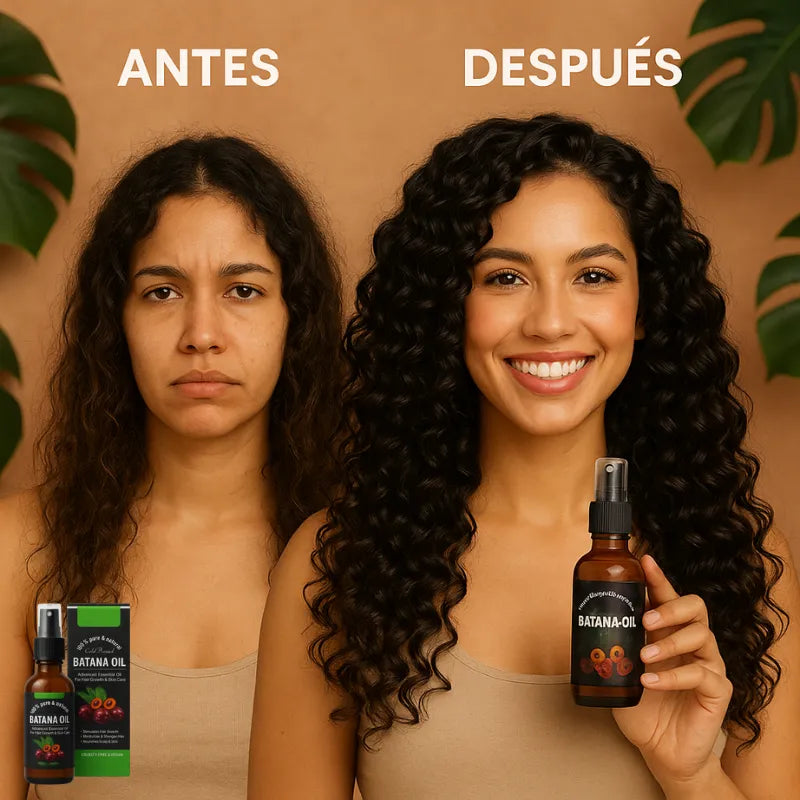Crecimiento Acelerado De Cabello – Batana Oil® (PAGA 1 Y LLEVA 3)