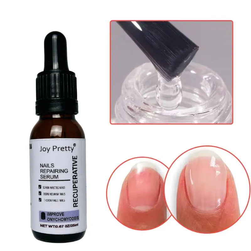 Nail Growth - UÑAS LARGAS Y FUERTES (Pague 1 y lleva 2)