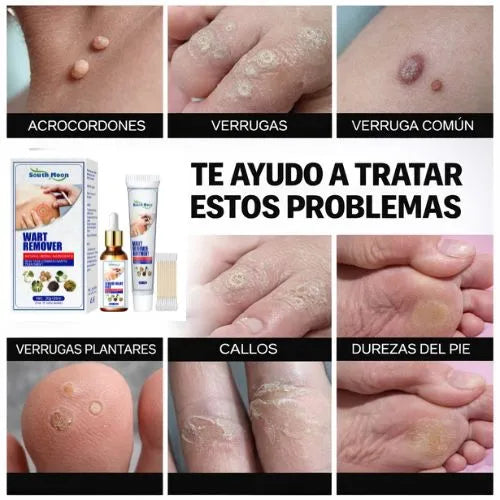Sérum + crema para verrugas: Elimina las arrugas desde la raíz