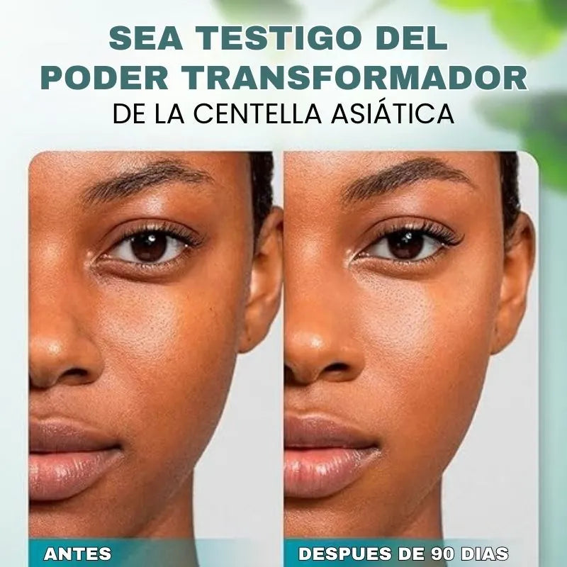 Serum De Niacinoma Y Centella Asiatica (Lleve 2 y pague 1)
