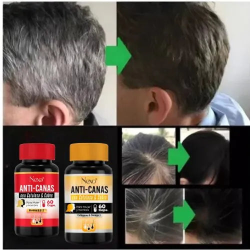 Desaparece las canas desde la raíz