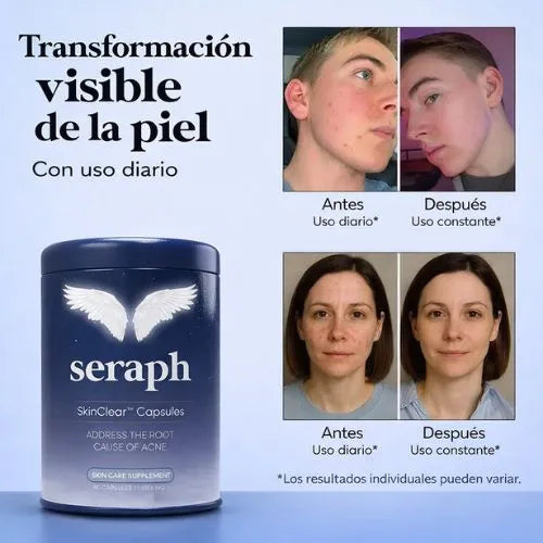 Combate el acné hormonal de forma natural