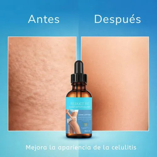 Sérum elimina celulitis y mejora la firmeza de tu piel