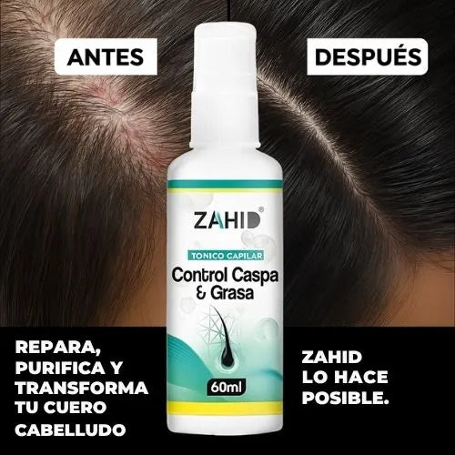 Fin a la Caspa y Grasa: Incluye Exfoliante Capilar