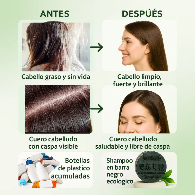 Control de Grasa y Caspa Jabón (PAGA 1 Y LLEVA 4)