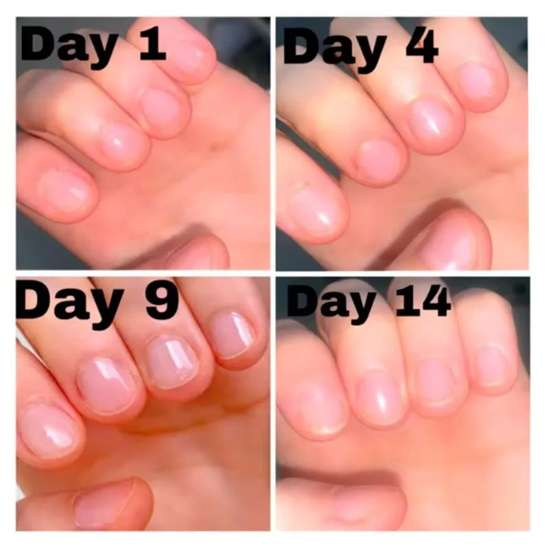Nail Growth - UÑAS LARGAS Y FUERTES (Pague 1 y lleva 2)