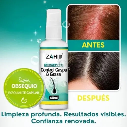 Fin a la Caspa y Grasa: Incluye Exfoliante Capilar
