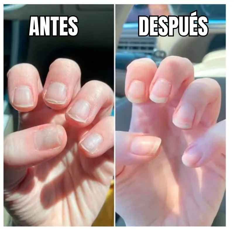 Nail Growth - UÑAS LARGAS Y FUERTES (Pague 1 y lleva 2)