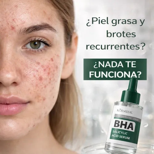Elimina el acné y sus cicatrices