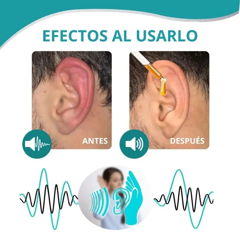 Earwax Off® - Elimina el cerumen y las infecciones al instante