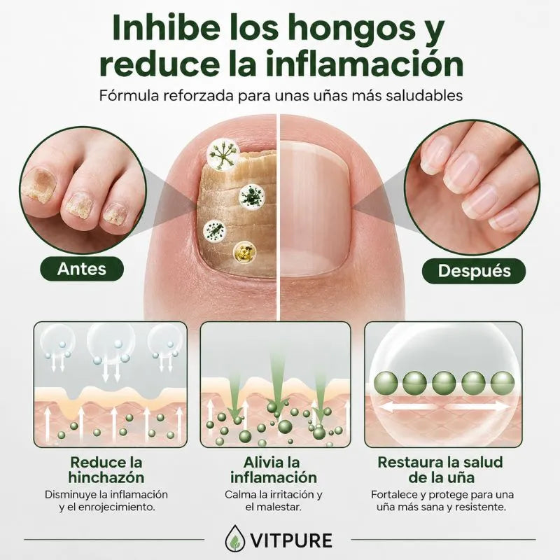 Fungix Pro - Protege y elimina el hongo de tus uñas con ingredientes 100% naturales