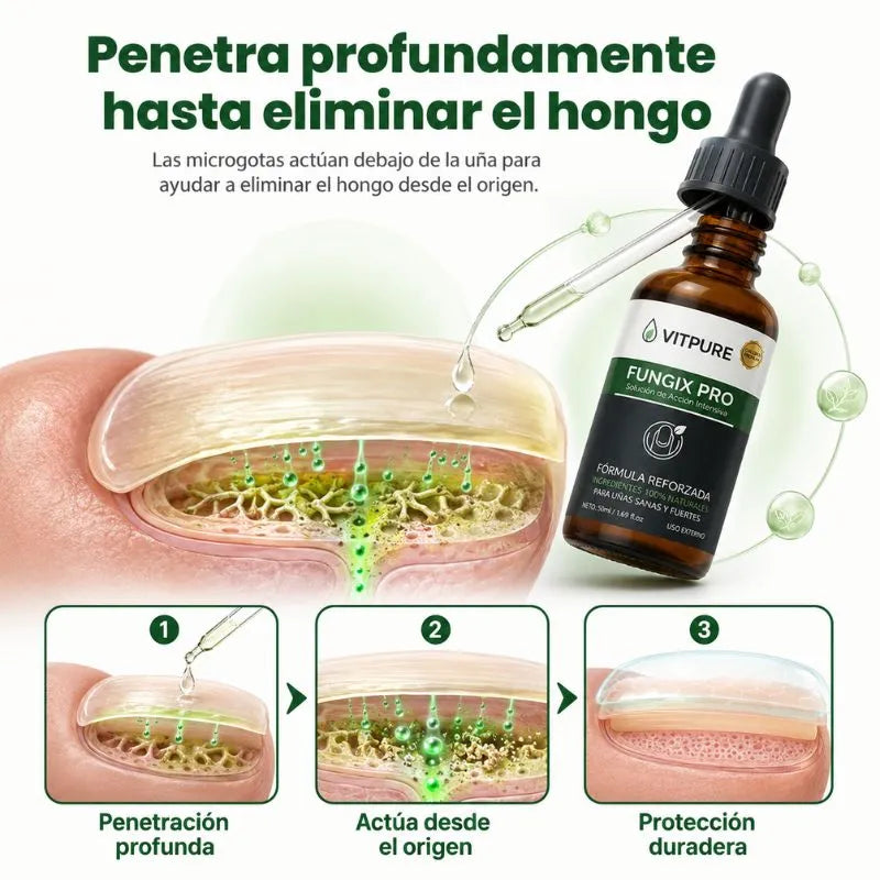 Fungix Pro - Protege y elimina el hongo de tus uñas con ingredientes 100% naturales