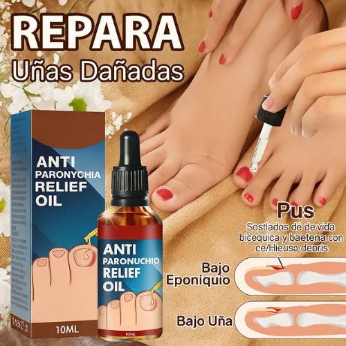 Protege y elimina el hongo de tus Uñas (PAGA 1 Y LLEVA 3 UNIDADES)