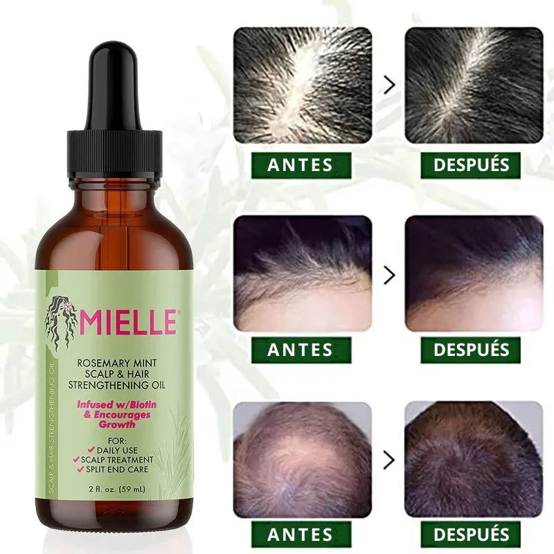 Serum Capilar - Crecimiento acelerado del cabello