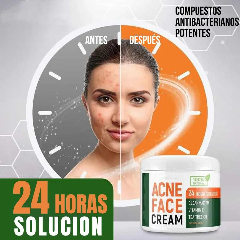 Crema Antiacne 24 Horas (2 Unidades)