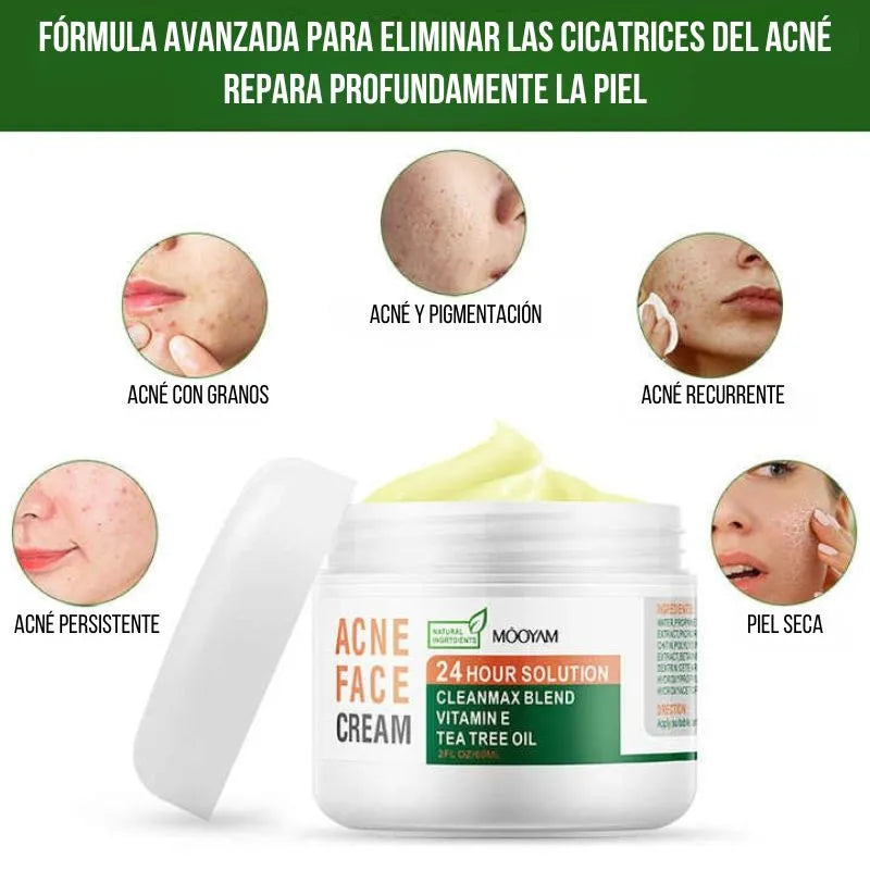 Crema Antiacne 24 Horas (2 Unidades)