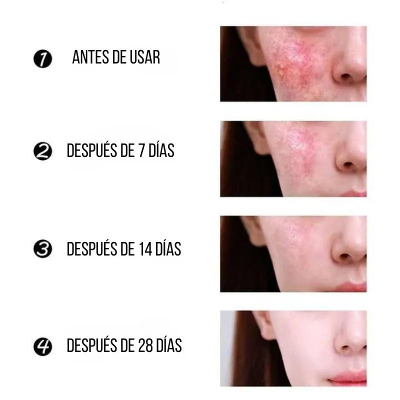 Crema Antiacne 24 Horas (2 Unidades)