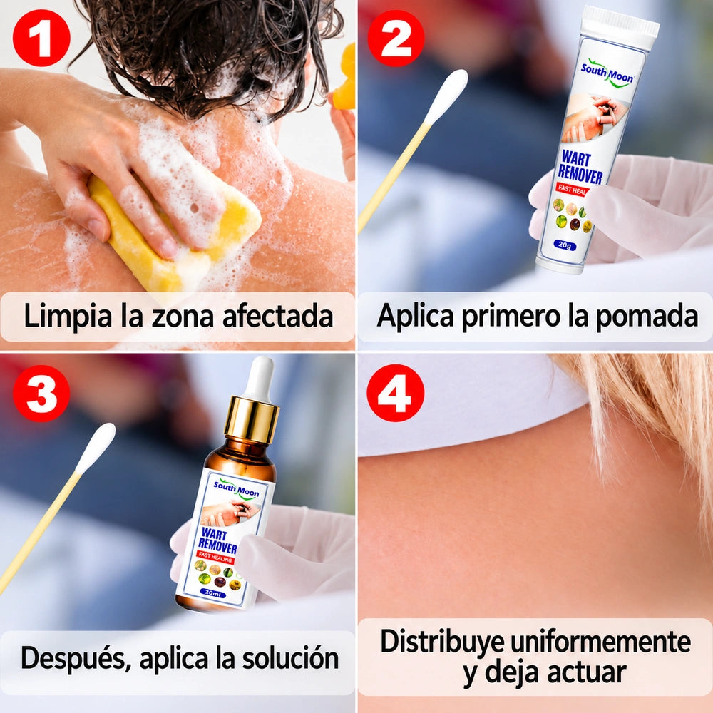 Kit Removedor de Verrugas South Moon – Líquido Natural + Crema para Eliminar Verrugas + Aplicadores