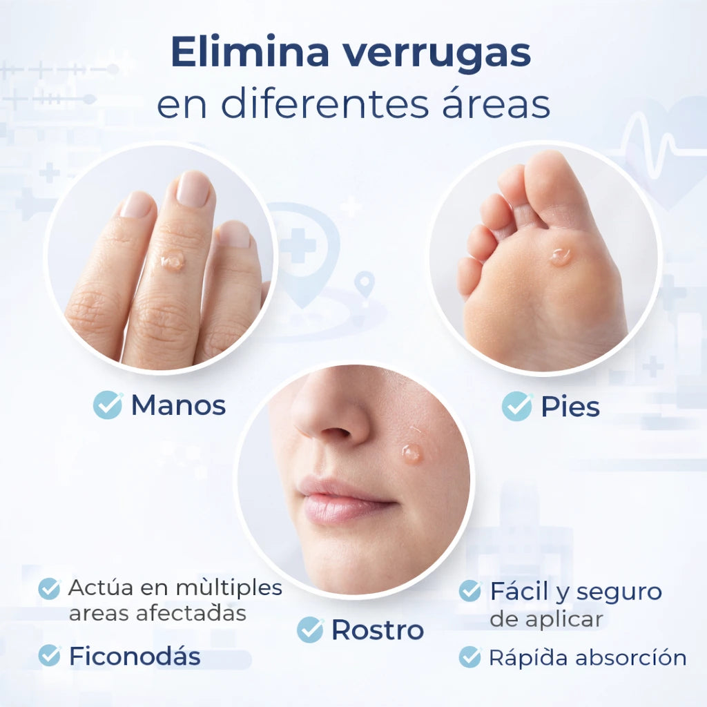 WartLift - Elimina las verrugas y mezquinos de forma natural