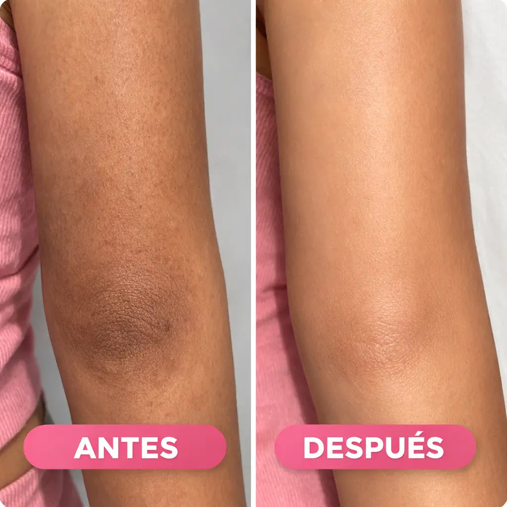 Antes y después de usar Azúcar Glow Exfoliator